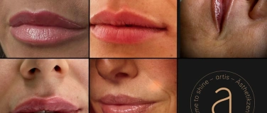 Event-Image for 'Lips Unlocked: The Art & Science of Lip Injections'