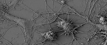 Event-Image for 'Einblick in die Ursachen neurodegenerativer Erkrankungen'